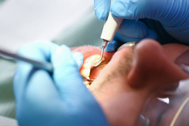 Best Emergency Treatment for Toothache in Haw River, NC